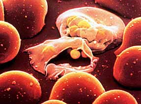 plasmodium_falciparum.jpg